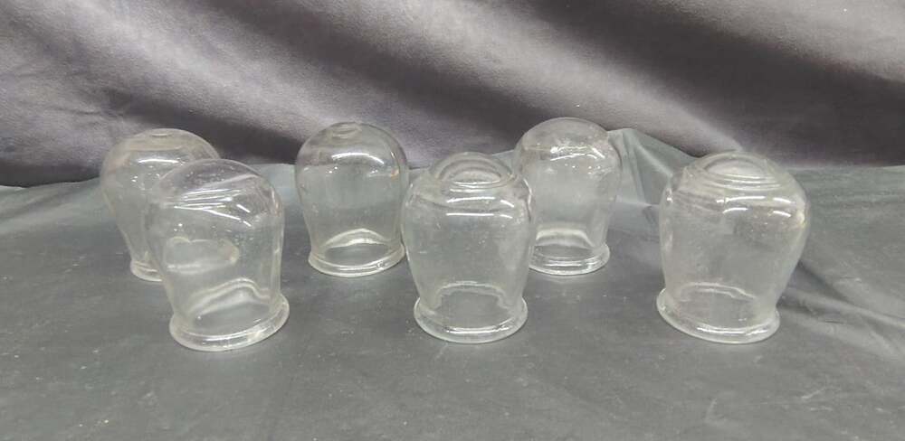 6 Antique 1800's Glass Bloodletting Quack Medical Barber Cupping Blood Cups